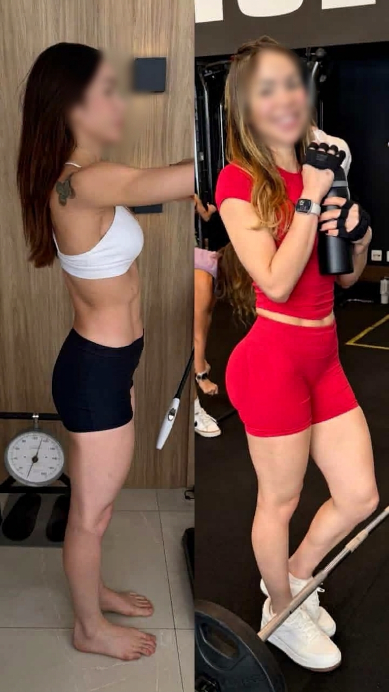 Antes e depois — Hipertrofia