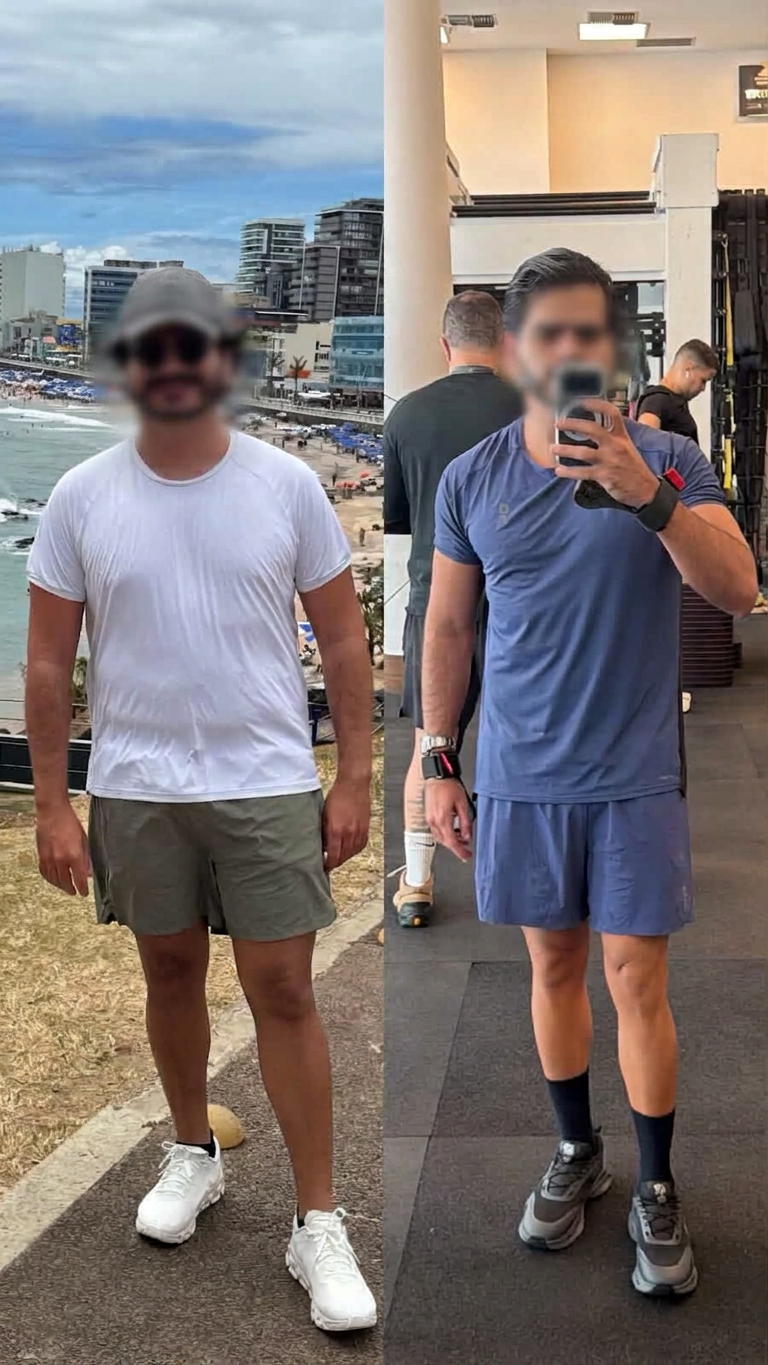 Antes e depois — Emagrecimento